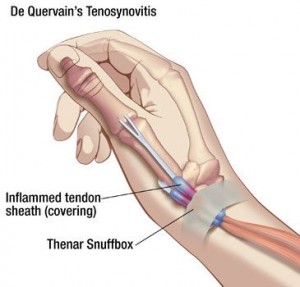 Hand Surgeon in Miami Beach