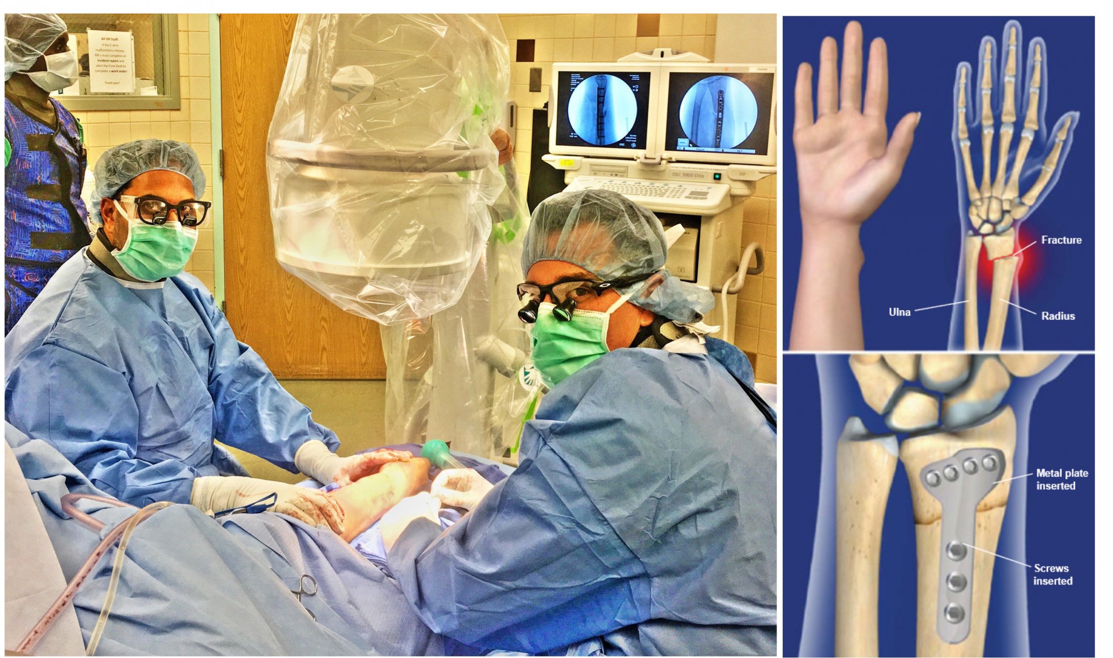 Hand Surgeon in Miami Beach