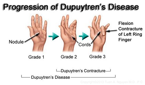Hand Surgeon in Miami Beach