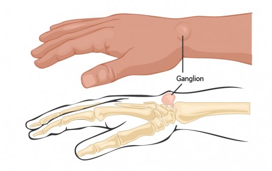 Hand Surgeon in Miami Beach